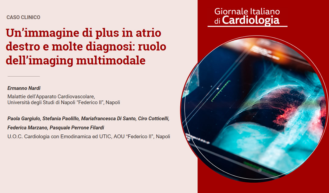 PLUS-IN-ATRIO