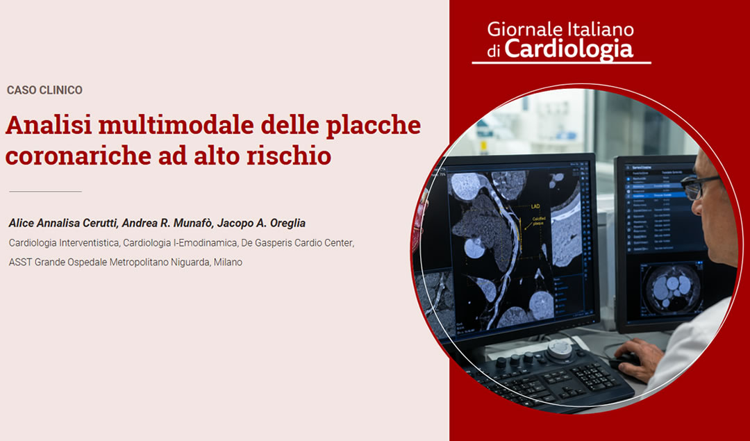 Consulta il lcaso sulle placche coronariche